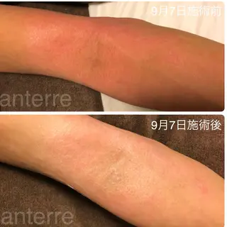 ピーリングサロン シャンテール所属・ピーリングサロン シャンテールのエステ・リラクイメージ