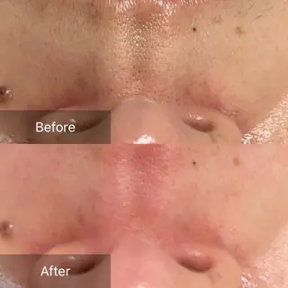 産毛専門店 Bittoのエステ・リラクイメージ