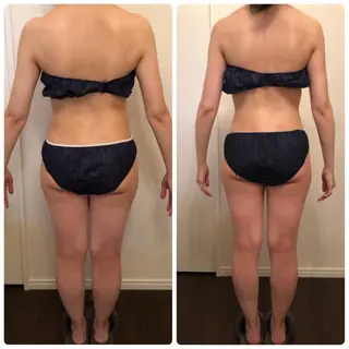 FLEUR大阪・美容 整体・痩身・小顔のエステ・リラクイメージ