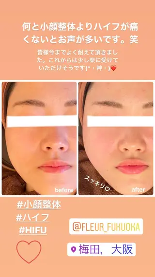 FLEUR大阪・整体 ・ハイフ・痩身・小顔のエステ・リラクイメージ