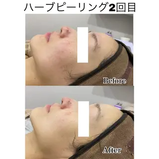 美肌サロンTIAM by tetoteのエステ・リラクイメージ