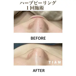 美肌サロンTIAM by tetoteのエステ・リラクイメージ