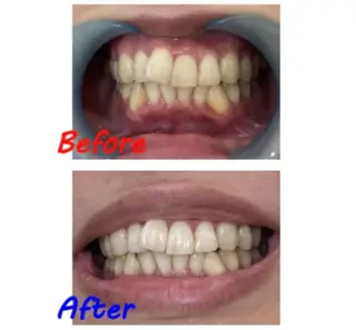 セルフホワイトニングサロン　ラヴィアン所属・ホワイトニングサロン La vie enのその他イメージ