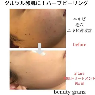 痩身専門サロン ビューティーグランツのエステ・リラクイメージ