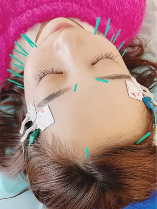 小顔美容鍼専門サロン 渋谷YZのエステ・リラクイメージ