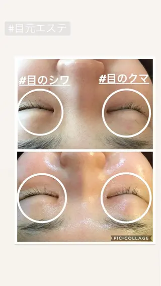 ニキビ/肌質改善専門 Snow skinのエステ・リラクイメージ