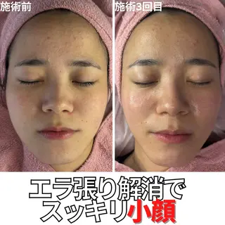 CHALON所属・１０日間しかしない エステサロンのエステ・リラクイメージ