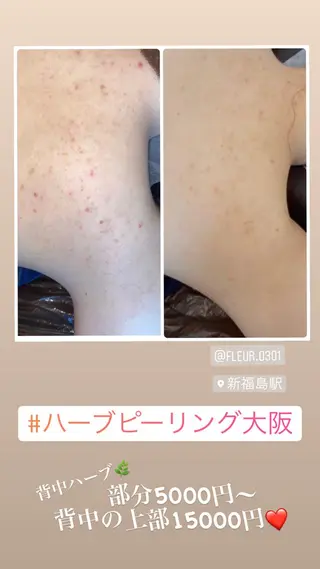 FLEUR大阪・整体 ・ハイフ・痩身・小顔のエステ・リラクイメージ