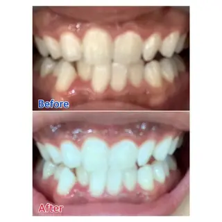 MBEAUTYSALON 千葉店・京成大久保所属・Melty 輝のその他イメージ