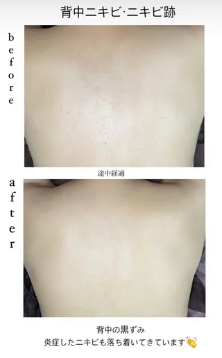 ベラージュ【美背中・ 美尻・フェイシャル】のエステ・リラクイメージ