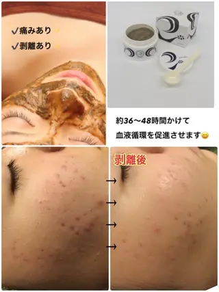 【リベルハーブピーリング認定店】敏感肌・美白脱毛専門店Dione立川店所属・Dione 立川店のエステ・リラクイメージ