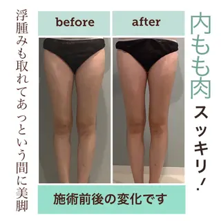 エステサロン JURISのエステ・リラクイメージ