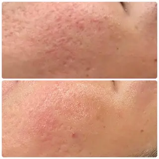 Gemini 　MIKIのエステ・リラクイメージ