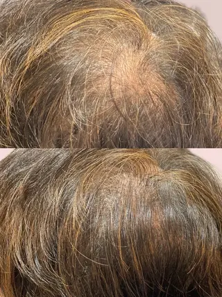 25ニコ所属・25 ニコのヘアスタイル