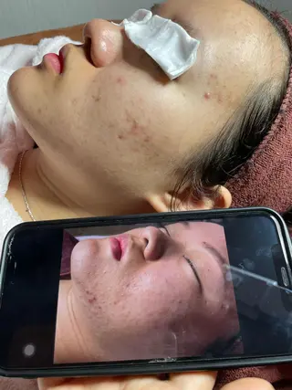 ニキビ、痩身、脱毛、 サクラチャンスパのエステ・リラクイメージ