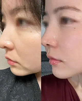 マツエク・マツパ aliaハイフ&水光ジェットサロン所属・aliaハーブ水光店 エステティシャン募集のエステ・リラクイメージ