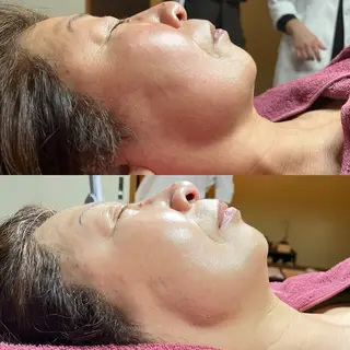 脱毛和みサロン新茶屋所属・脱毛和みサロン新茶屋 ひろみ（女性専用）のエステ・リラクイメージ