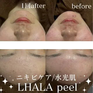 美肌salon GRAN CUORE所属・Natsuki🌙 GRAN CUOREのエステ・リラクイメージ