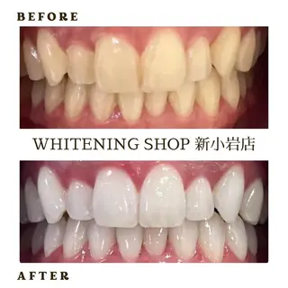 メンズ ホワイトニング ショップ新小岩店のその他イメージ