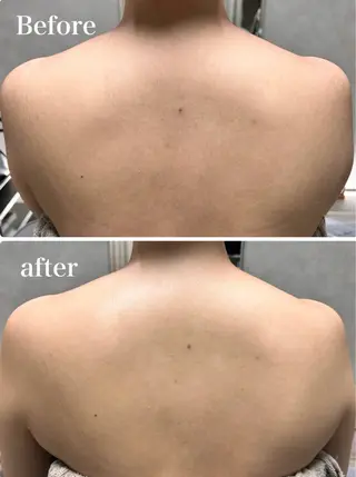 OOPARTS所属・大塚 杏美のエステ・リラクイメージ