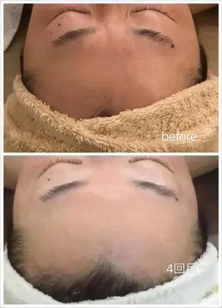 OPREA 栄店のエステ・リラクイメージ