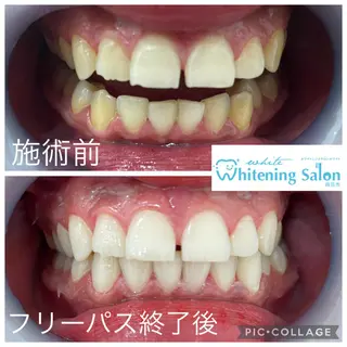 メンズ キッズ ネイル マツエク・マツパ ホワイトニング&アイラッシュ四日市ホワイト所属・アイラッシュ ホワイトニング四日市のマツエク・マツパデザイン