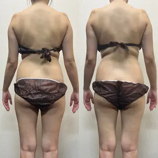 ハイパーナイフ専門店 Salon de COCO所属・Salon de COCOのエステ・リラクイメージ