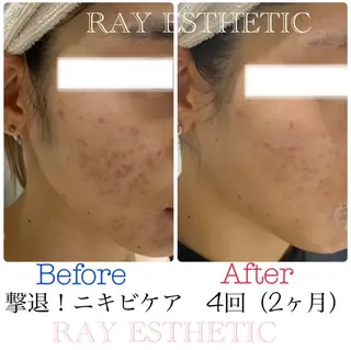 RAY Beauty エステ 一宮店のエステ・リラクイメージ