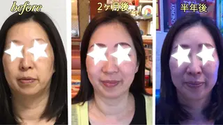 エステサロン ahaha所属・エステサロン ahahaのエステ・リラクイメージ