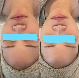 中目黒ハーブピーリン グ🌿ララピールのエステ・リラクイメージ