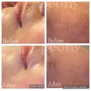 デトックス美容専門サロンpeony所属・デトックス美容専門 サロンpeonyのエステ・リラクイメージ