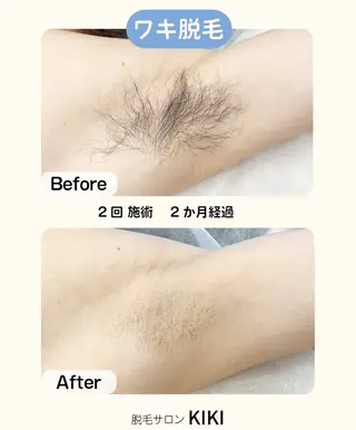 脱毛サロンKIKI所属・脱毛サロンKIKI みゆのエステ・リラクイメージ