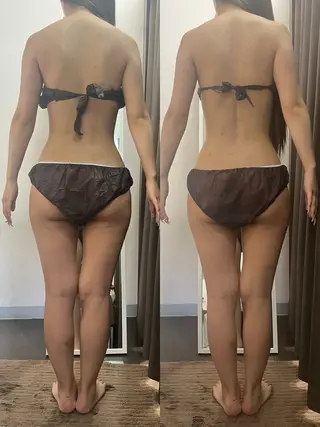 ハイパーナイフ専門店　Salon de COCO所属・Salon de COCOのエステ・リラクイメージ