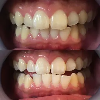 LBSホワイトニング 新宿店💝店長熊倉のその他イメージ