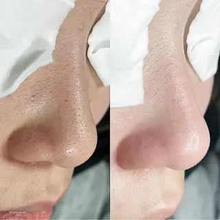 C. Lのマツエク・マツパデザイン