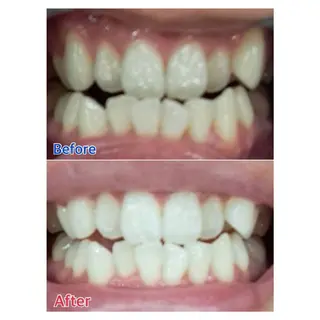 MBEAUTYSALON 千葉店・京成大久保所属・Melty 輝のその他イメージ