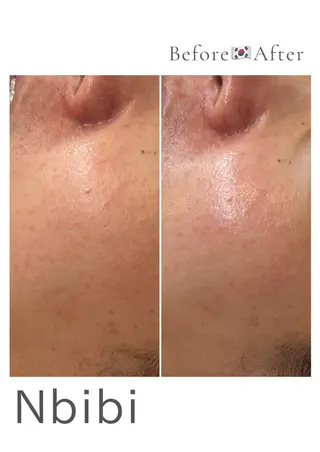 韓国🇰🇷価格 サロン_Nbibiのエステ・リラクイメージ