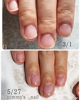 ネイル tommy's nail所属・福岡/若よもぎ蒸し 全身美容が叶うサロンのネイルデザイン
