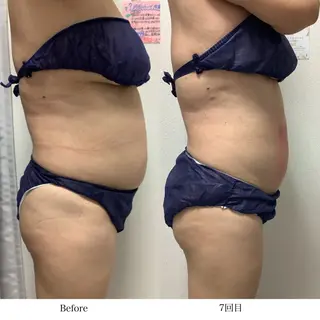 冷却専門店 SLARIのエステ・リラクイメージ