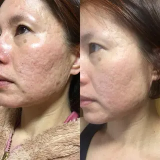 hotty ホッティーのエステ・リラクイメージ