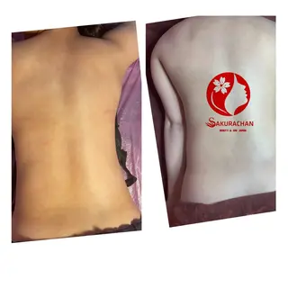 ニキビ、痩身、脱毛、 サクラチャンスパのエステ・リラクイメージ