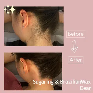 シュガーリング&ブラジリアンワックスサロンDear所属・シュガーリングサロン Dearのエステ・リラクイメージ