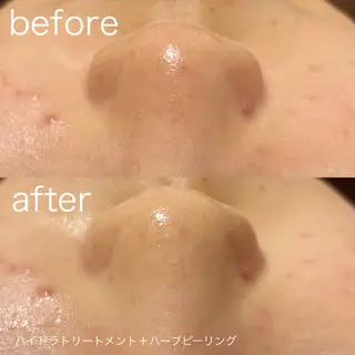 lulularico Yuのエステ・リラクイメージ