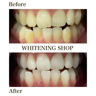 ホワイトニングショップ静岡葵区店所属・ホワイトニング ショップ静岡葵区店のその他イメージ