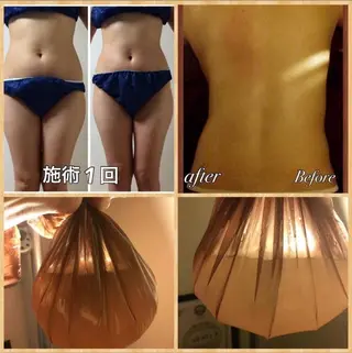 【痩身】インドエステ ＆筋膜リリースのエステ・リラクイメージ