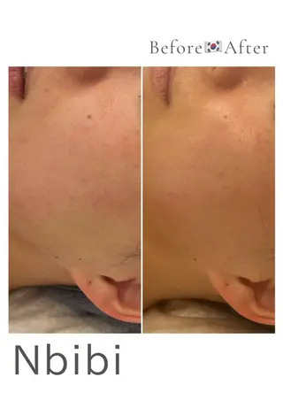 韓国🇰🇷価格 サロン_Nbibiのエステ・リラクイメージ