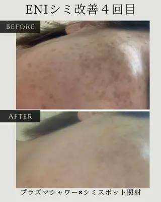 シミ毛穴ケア EsteAのエステ・リラクイメージ