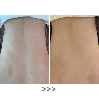 肌質改善 KALANCHOEのエステ・リラクイメージ