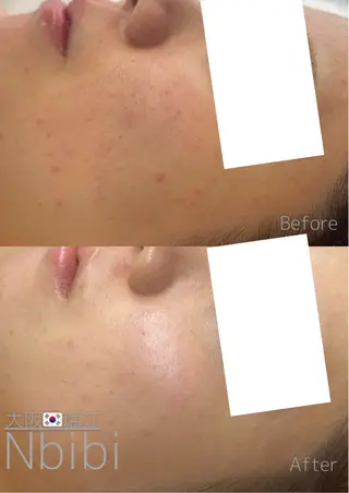 韓国🇰🇷価格 サロン_Nbibiのエステ・リラクイメージ