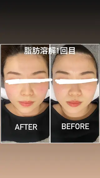 毛穴洗浄・痩身・脱毛 /アルカンジュのエステ・リラクイメージ